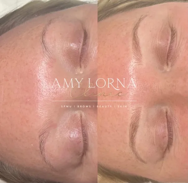 Before and after brows by Amy, client photo 4 of 14