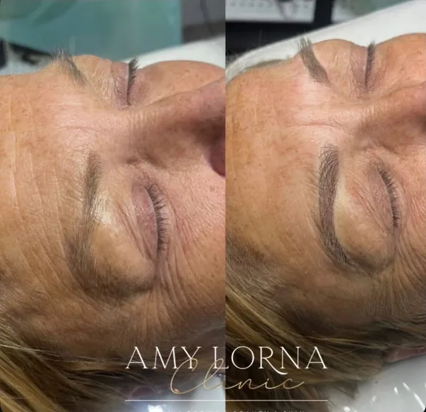 Before and after brows by Amy, client photo 6 of 14