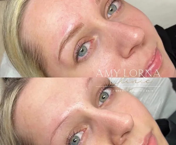 Before and after brows by Amy, client photo 13 of 14