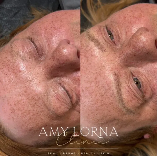 Before and after brows by Amy, client photo 14 of 14